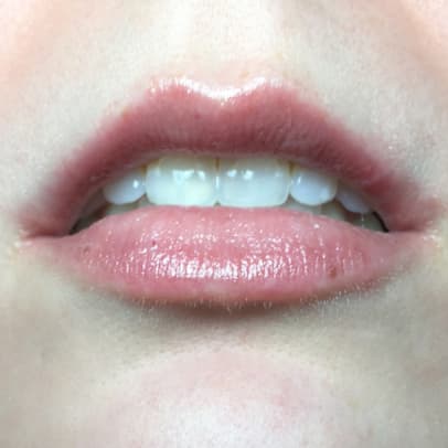 Dr. Brandt Needles No More 3-D Lip Plump Fix