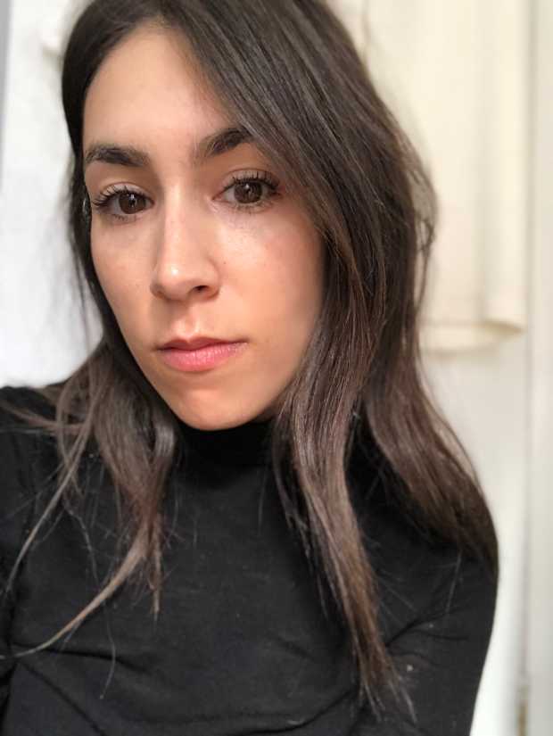 dark under eyes filler